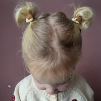 Haarelastiekjes Egel